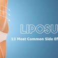 long term side effects of liposuction is liposuction good laser liposuction side effects what is liposuction surgery is liposuction painful is liposuction worth it 13 Most Common Liposuction Surgery Side Effects You Must Know Here are 13 Most Common Liposuction Surgery Side Effects You Must Know Before Going Through Liposuction Surgery.is Liposuction Good or Painful?