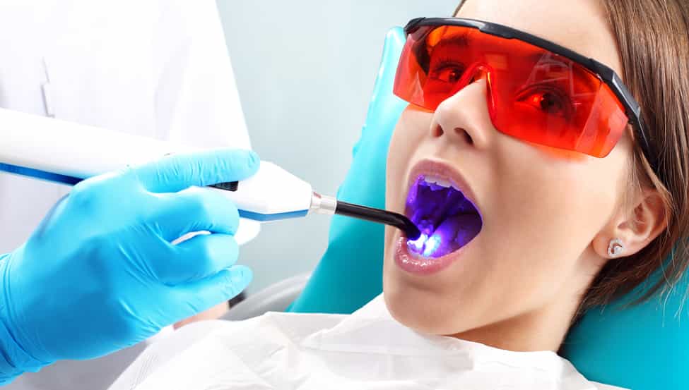 The Details Of Laser Dentistry You Need To Know
